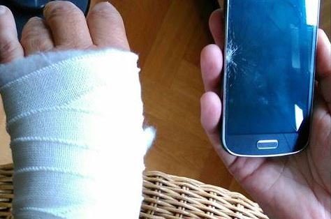 Auto rijdt Rijswijks raadslid aan